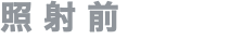 照射前