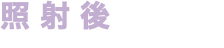 照射後