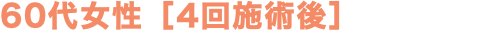60代女性［4回施術後］